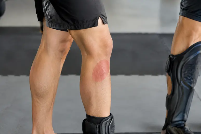 Gros plan sur la zone latérale sous le genou ciblée par un calf kick en entraînement